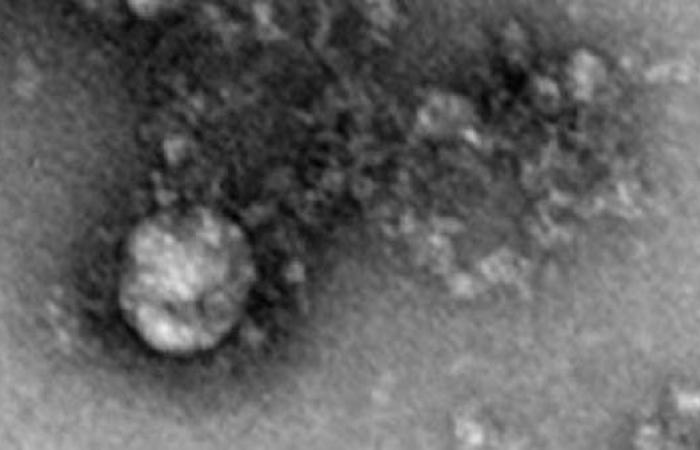 شاهد أول صورة للطفرة البريطانية القاتلة من فيروس كورونا