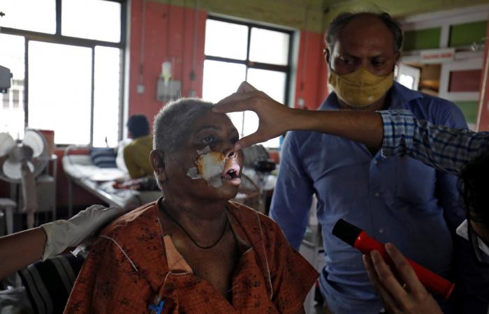 إزالة عيون وأنوف.. 45 ألف إصابة بالفطر الأسود في الهند