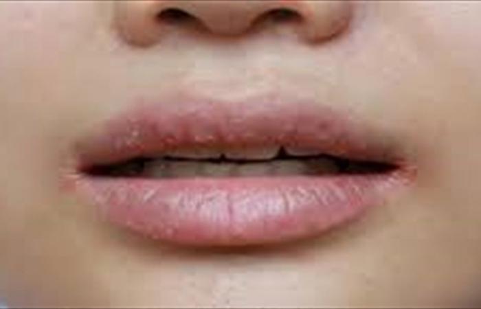 هل تعانون من مشكلة جفاف الفم؟... اليكم بعض المعلومات