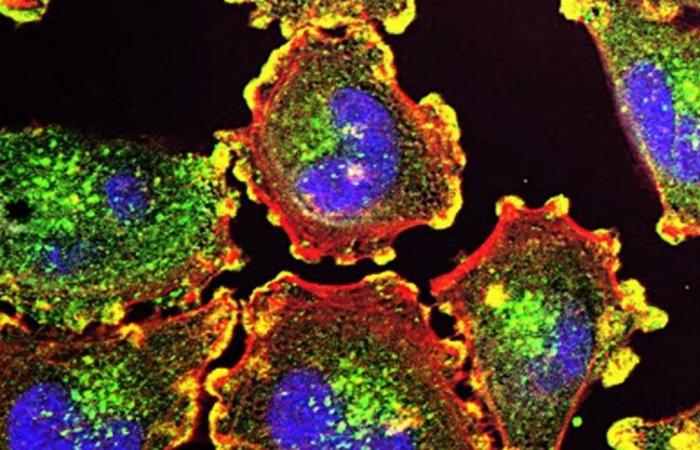 طريقة جديدة لتحسين قدرة الجسم على التعرف على الخلايا السرطانية ومكافحتها