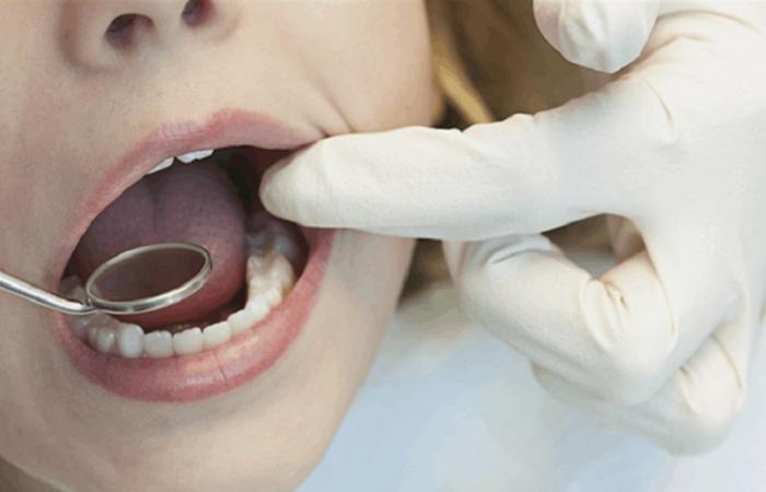 اكتشاف سبب بيولوجي يزيد خطر تسوس الأسنان وأمراض اللثة