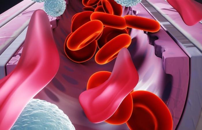 ​عناصر غذائية لمكافحة فقر الدم .. تعرف عليها