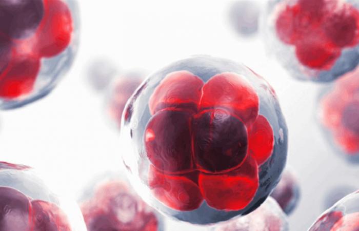 خصائص مرض الورم النقوي المتعدد