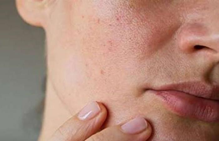 هذه العلامات تدل على إصابتكم بالجفاف