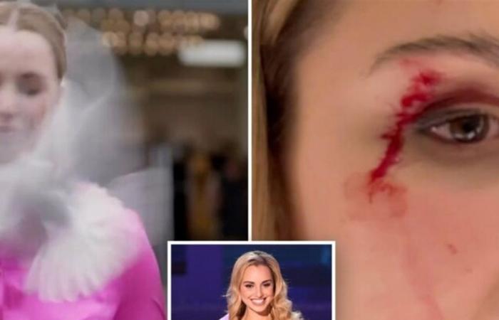 حادث غير متوقع.. طائر يهاجم مراسلة على الهواء (فيديو)