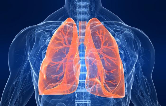 مرضى سرطان الرئة في لبنان في خطة جديدة