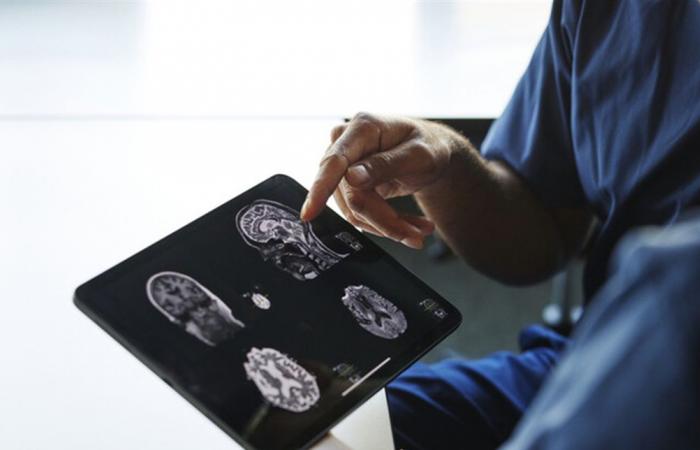 دراسة تكشف العلاقة بين حجم الرأس وخطر الخرف