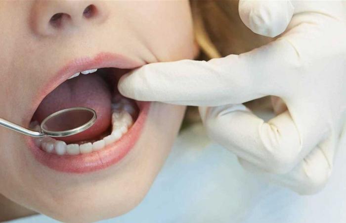 تعطيل "لغة البكتيريا" يفتح بابًا جديدًا للوقاية من تسوس الأسنان