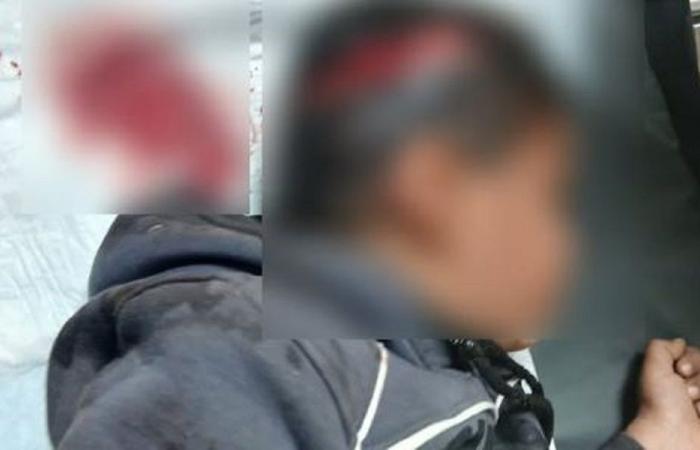 كلب يمزّق فروة رأس طفل في بعلبك