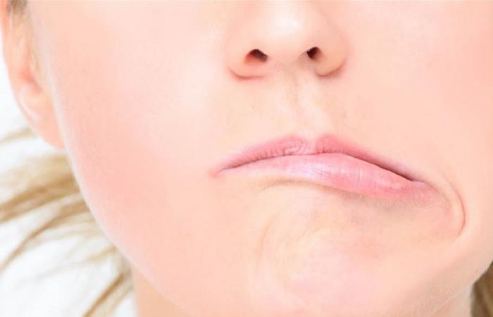 بسبب أزمة نفسية.. فنانة شهيرة تُصاب بمرض العصب السابع في وجهها (فيديو)