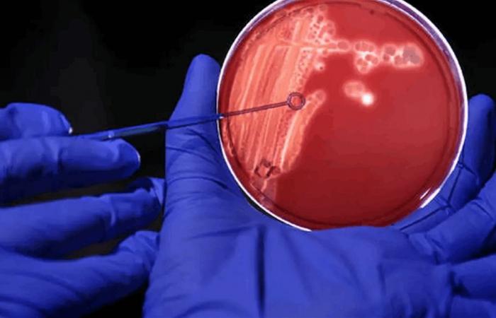 دراسة كورية تربط بكتيريا تسوس الأسنان بمرض باركنسون