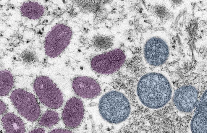تحذير ودعوة لليقظة.. اكتشاف سلالة جديدة لأحد الفيروسات