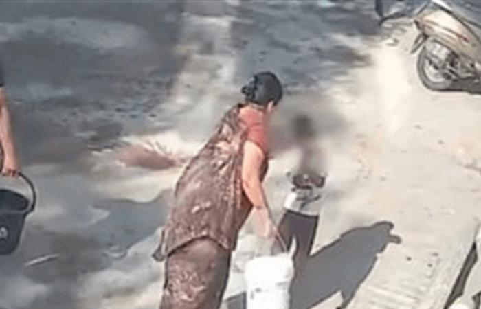 خلال احتفالات.. جدّة سكبت الماء المغلي على طفل