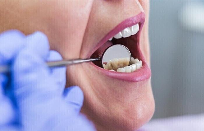 ما تأثير التهابات الفم على القلب؟