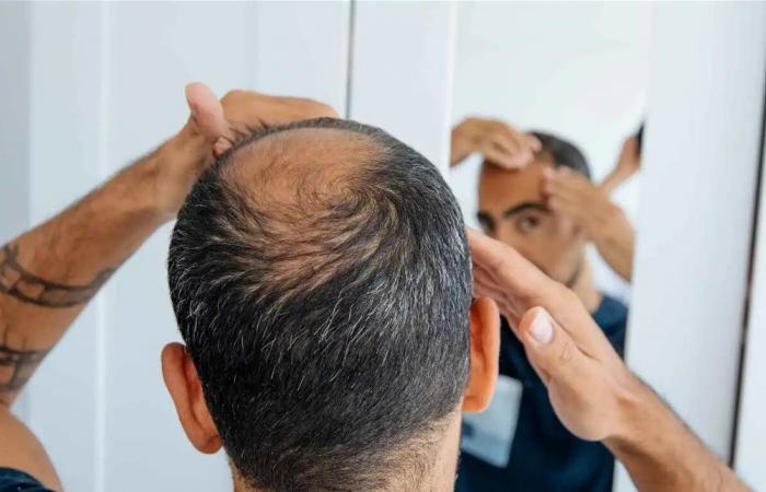 هل الصلع يحمي الرجال من السرطان؟
