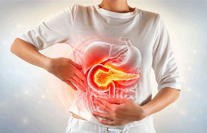 احمِ مرارتك.. أطعمة وعادات قد تمنع تكوّن الحصوات