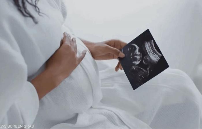 هل ترتبط أدوية حديثة للصداع النصفي بزيادة خطر الإجهاض؟