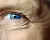 يهدد كبار السن.. مرض شائع يصيب العين ويدمر العصب البصري
