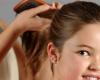 ما هي اسباب تساقط الشعر عند الاطفال ؟