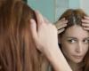 5 أسباب رئيسية تؤدي إلى تساقط الشعر.. تعرفوا عليها